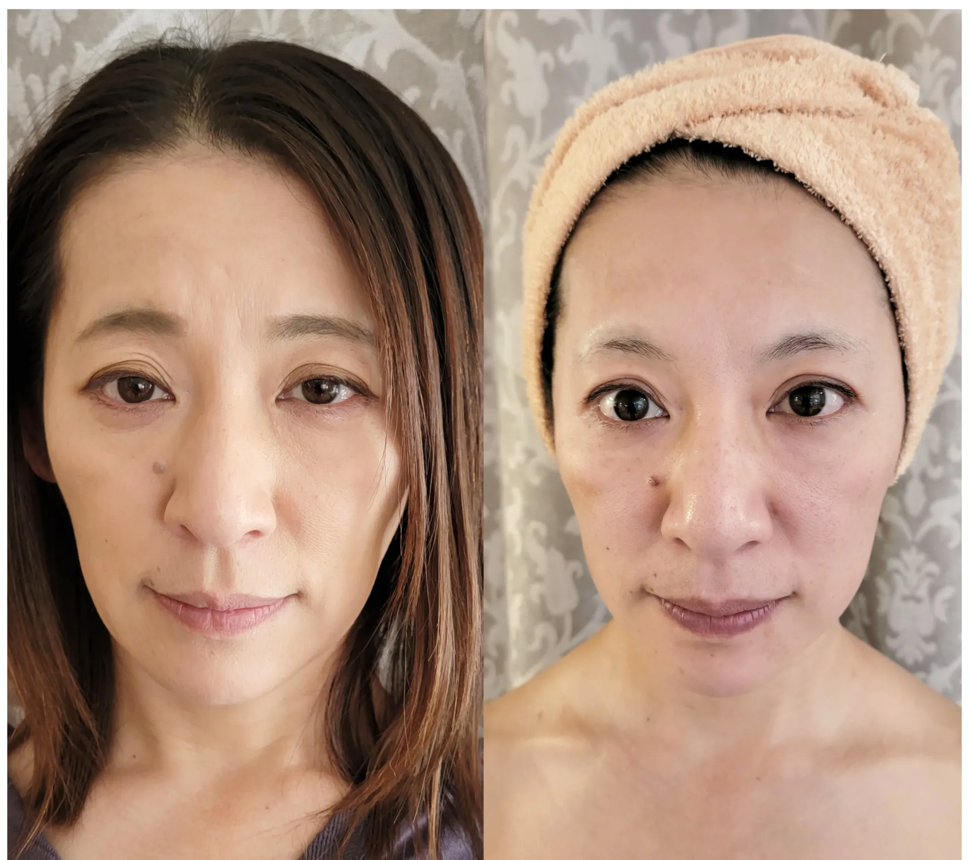 40代女性の方で「小顔効果」を目的にご来店されました！神戸市のエステサロン「bisMaquillage」